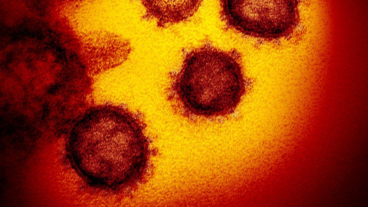Coronavirus: El momento de una Europa social